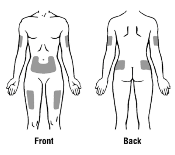 Subcutaneous injection site planning diagram